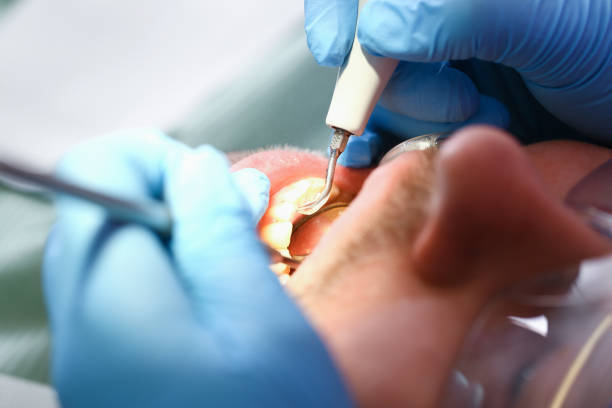 Best Emergency Cosmetic Dentistry (e.g., broken veneers) in Bellingham, WA