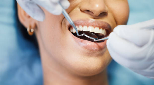 Best Weekend Emergency Dental Services in Bellingham, WA